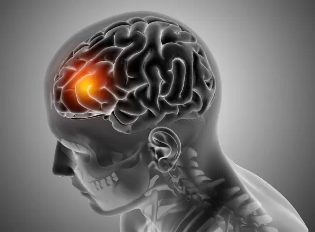 Concussion Causes Symptoms Recovery